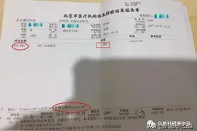 HIV病毒载量突然高于检测值了是怎么回事？图片
