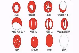 女人第一次会痛、会流血？关于这层膜的事，还有不少男女有误解图片