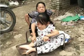 妈妈生下瓷娃娃女儿，长到18岁仍靠人照顾，做了母亲却苦了孩子图片