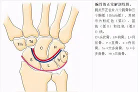 腕关节影像 | 解剖、骨折、脱位（值得收藏）图片