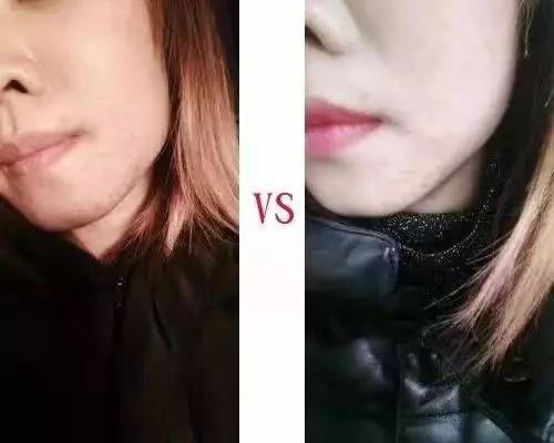 美肌冻干粉有什么作用 美肌冻干粉有什么作用和功效