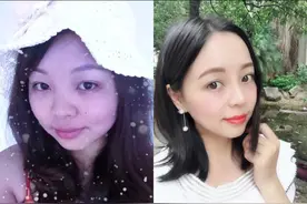 我做了一个成功的鼻综合图片