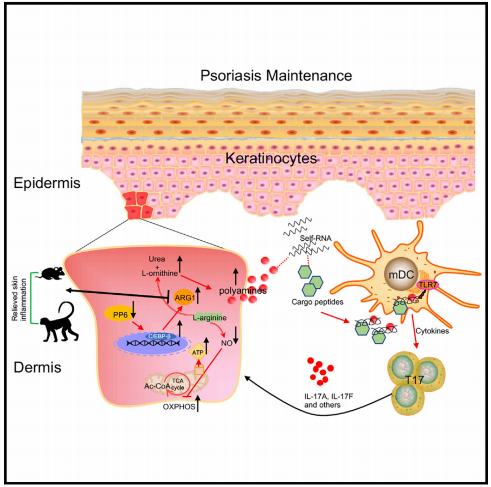 上海交通大学王宏林等揭示代谢过程异常加重牛皮癣的机制