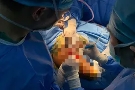 罕见高能！卧推190公斤，胸大肌严重撕裂！图片