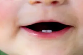 宝宝8个月长第一颗牙算晚吗？宝宝出牙时间标准，家长对照一下视频封面
