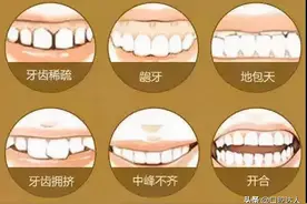 牙齿松动怎么办？只能等着它掉落吗？图片