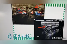 福州7岁女童因腹痛被送急诊…这次真不是阑尾的锅！而是这种病！春季高发图片