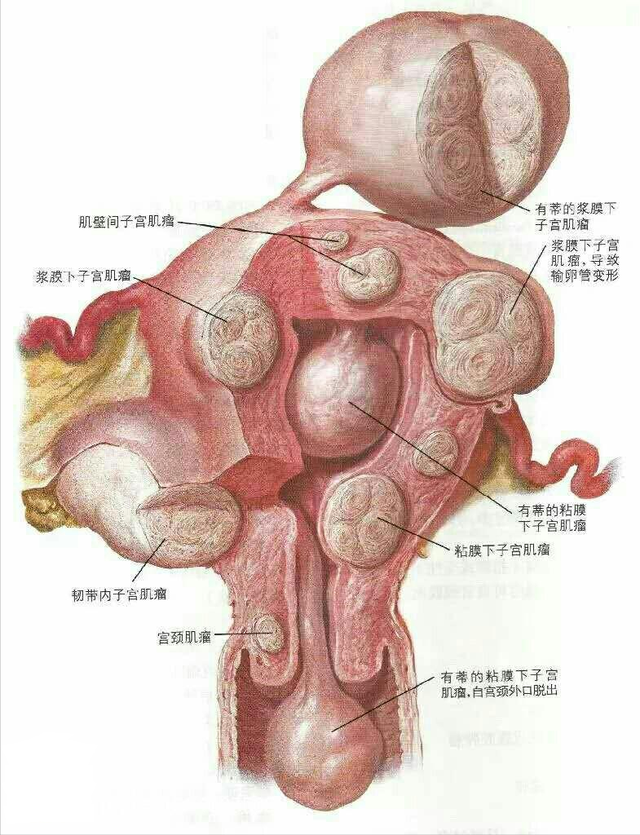 什么是滋养细胞（四种常见妇科恶性肿瘤）