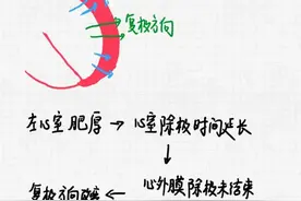 心电图九九八十一难之十左心室肥大图片