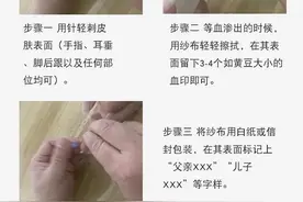 隐私亲子鉴定的常见生物类样本采集方法图片