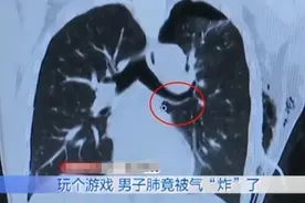 男子打游戏连跪4小时，气到肺炸被送医抢救，醒来后：队友太坑了图片