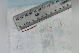 3.5厘米木刺扎入手掌，提醒：细小异物X片等很难排除，应及时就医图片