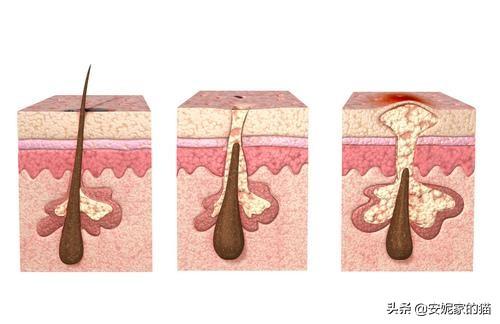 脸上皮肤呈鸡皮