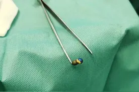 这种玩具又出事！接连七个娃进手术室图片