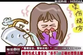 【暑期安全】烧烫伤成儿童安全“杀手” 正确处理很关键图片
