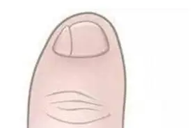 小脚趾上有“两瓣甲”，是纯种汉人的标志？专家给出了科学的解释图片