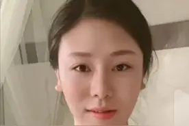 29岁美女打瘦脸针居然成了面瘫 美女变丑女 有可能一辈子都恢复不了图片