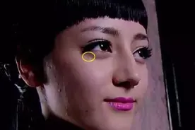 别再用针挑！用它，脂肪粒自己“掉”下来，效果胜过医美激光图片