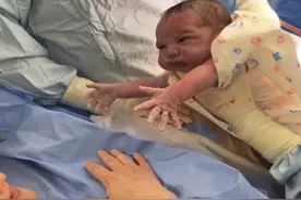 新生儿不愿与妈妈分离，张开双臂“求抱抱”，医生：忘喝孟婆汤了图片