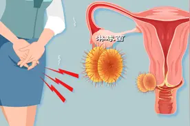 全球每年约20万妇女得淋病？淋病知识解读图片