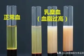 抽出来的血呈乳白色，治疗8天后变正常，这期间经历了什么？图片