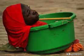 坚强的姑娘：全身上下“仅剩”头部，出门靠一个盆，还要赚钱养家图片