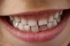 为什么孩子早晚刷牙，牙齿还是不够白？图片