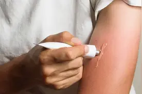 施得美治疗妊娠纹的效果怎么样图片