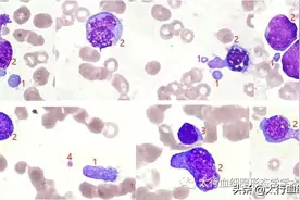 你知道浆质体吗？图片