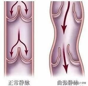 拉开身上“筋结”，缓解多种疾病！专家独门拉筋法