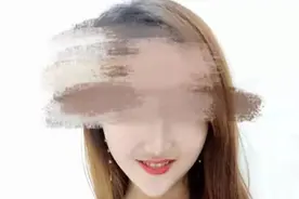 盲目追求瓜子脸，将自己整成这样，血淋淋的教训图片