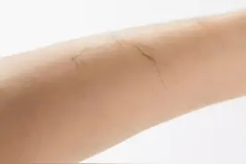 女性这3处毛发旺盛，是好事还是坏事？或许很多人都想错了图片