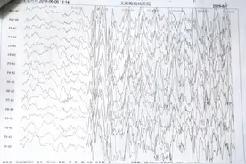 当哭泣的癫痫襁褓遇上医学奇迹 让希望重归于心图片
