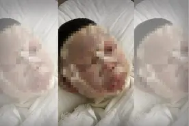 常州一小学教师做实验发生事故 4学生局部Ⅱ度烧伤图片