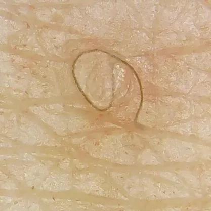 野脚鸡皮肤穿裙子 野脚鸡皮肤穿裙子