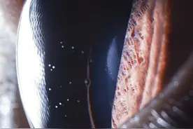 拍摄方法保密！物理博士记录上百双眼睛里的星辰大海图片