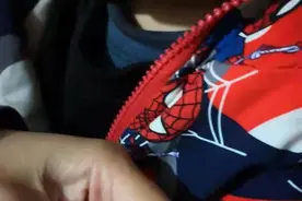 橡皮筋缠绕3天，2岁男童手指紫黑险些截肢！医生提醒：生活中孩子的异常表现需被重视图片