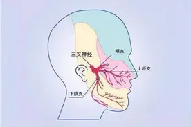 牙疼就是三叉神经痛吗？快来一探究竟吧图片