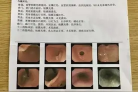 业绩不佳，女员工被罚吃“死神辣条”进医院，一个月后被要求离职图片
