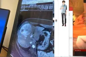 PDD手术复查出大问题，再不控制人直接没了？扬言自律却遭质疑图片