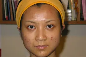 6个表现，说明你脾虚、脾湿了，快对照看看自己有没有中招图片