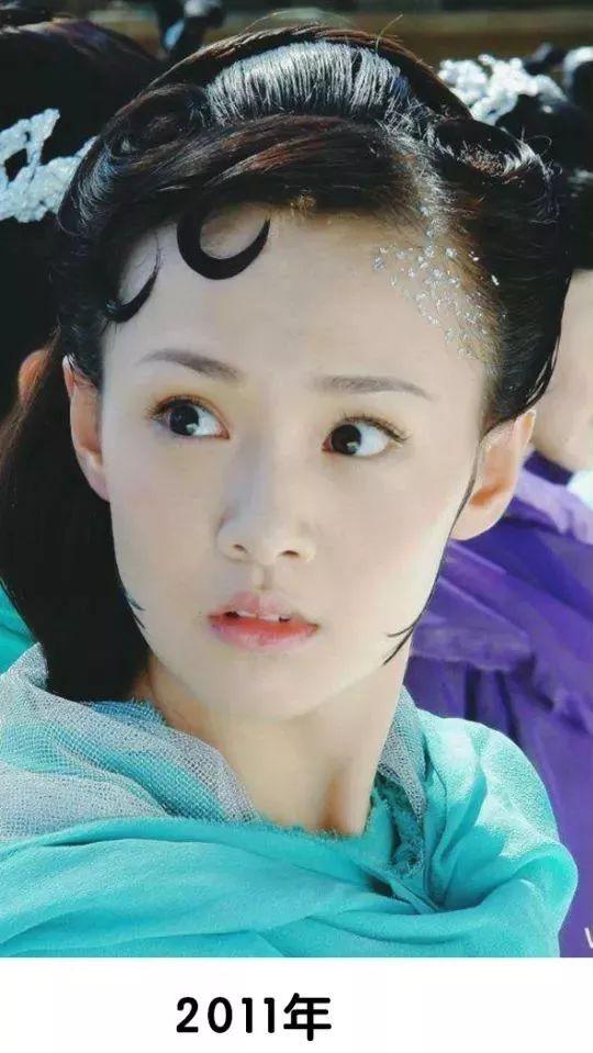 郑爽十年换了4张脸,最新路拍生曝光,假体都藏不住了