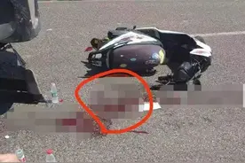 摩托车祸撞飞“蛋蛋”，散落滚烫柏油马路上，还能再移植回去吗？图片