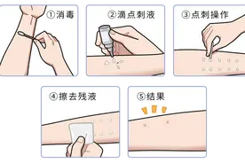 湿疹、带状疱疹，哪些皮肤病会传染？记住，这3种可能“人传人”图片