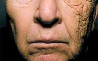 鑷敺浜鸿濡備綍娲楃櫧锛? onerror=