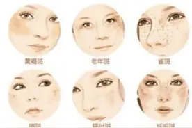 想要淡斑点，记住这三种维生素图片