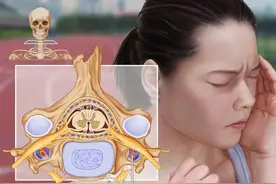 走近神奇的中医正骨疗法｜脊椎错位莫忽视——颈椎小关节紊乱症图片