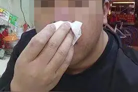 “车比你命值钱，”因拒付260元代驾费，醉酒奥迪车主殴打辱骂代驾员致满脸鲜血，车主：要我赔4万是讹钱图片