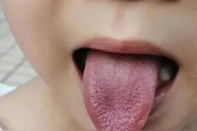 孩子总拉羊屎蛋、总便秘，用食疗给肠道补点津液图片