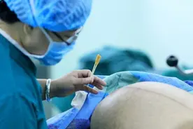 宁愿肚子上留疤，也不愿意顺产，女明星为什么会如此钟爱剖腹产？图片